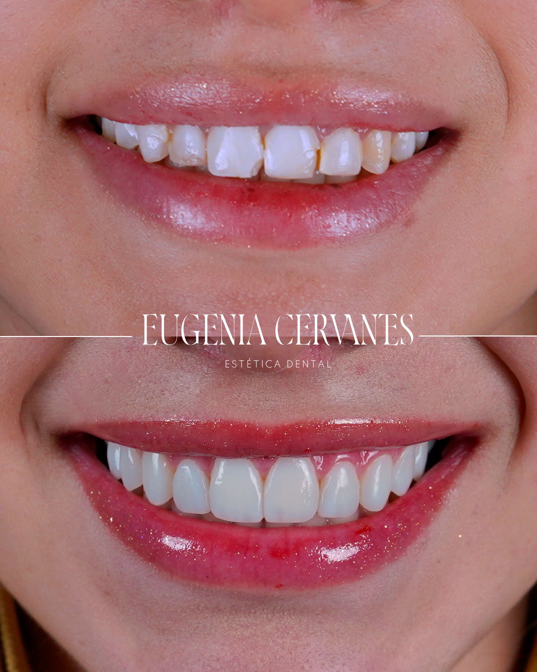 eugenia cervantes antes y despues 2 jpg Eugenia Cervantes | Clínica Dental en Madrid