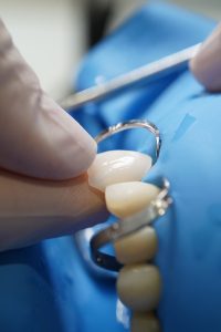 DSC02346 Eugenia Cervantes | Clínica Dental en Madrid