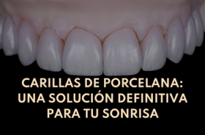 Texto Eugenia Cervantes | Clínica Dental en Madrid