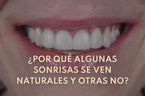 Texto 2 Eugenia Cervantes | Clínica Dental en Madrid