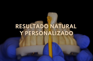 Texto 1 Eugenia Cervantes | Clínica Dental en Madrid